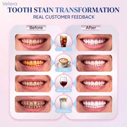 Velora™ Niacinamide Toothpaste