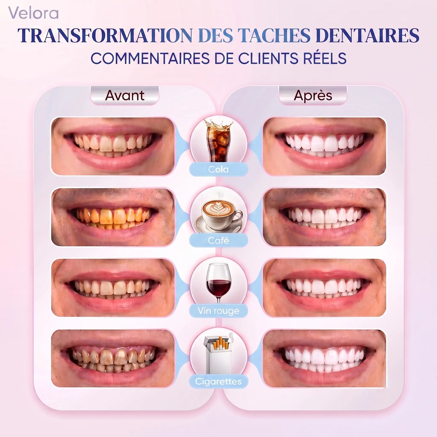 Velora™ Niacinamide Toothpaste