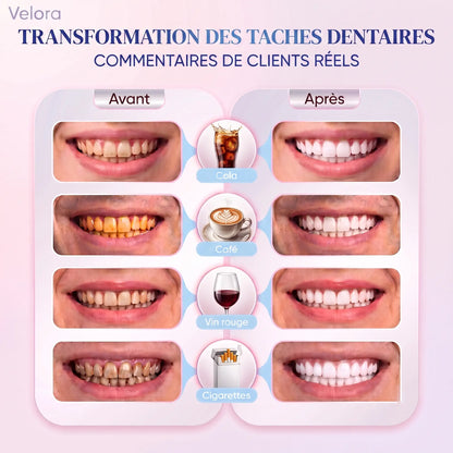 Velora™ Niacinamide Toothpaste